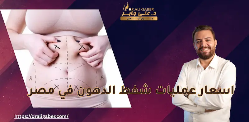  شفط الدهون 