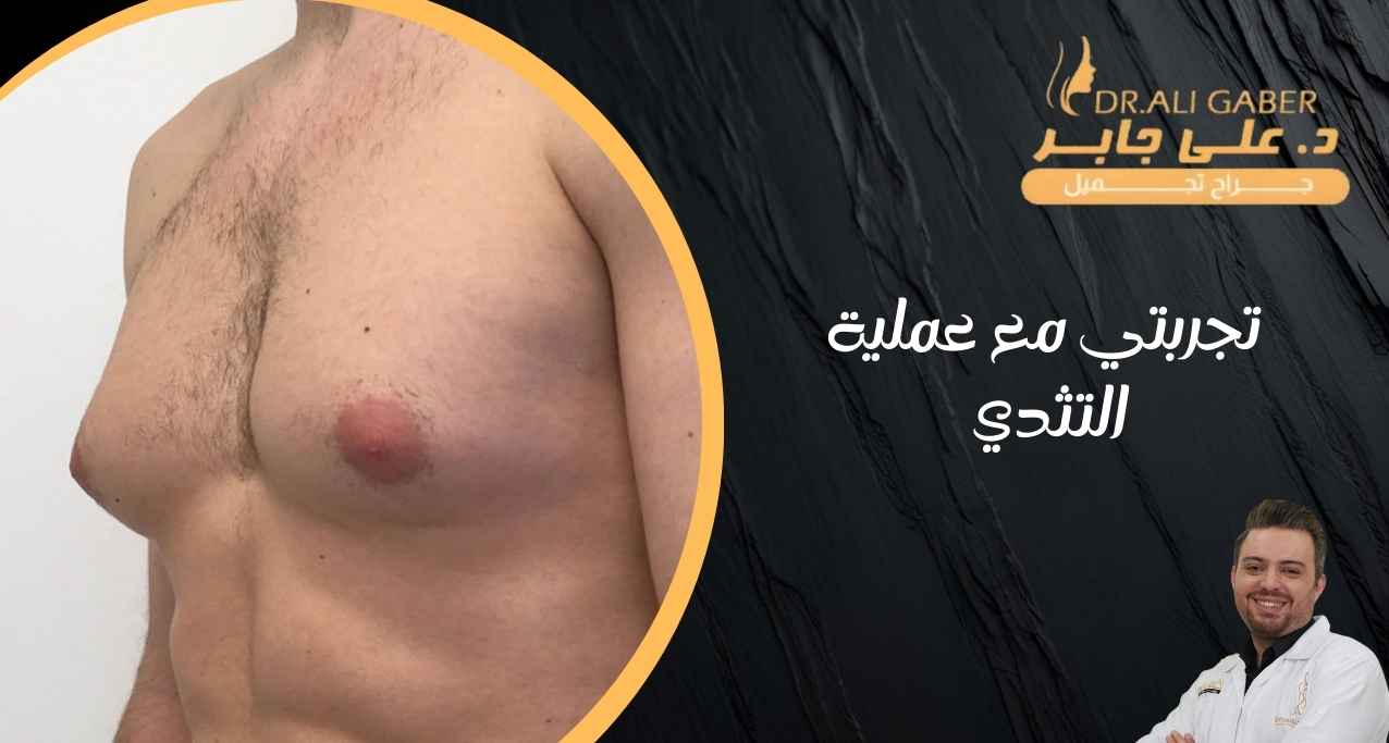 تجربتي مع عملية التثدي