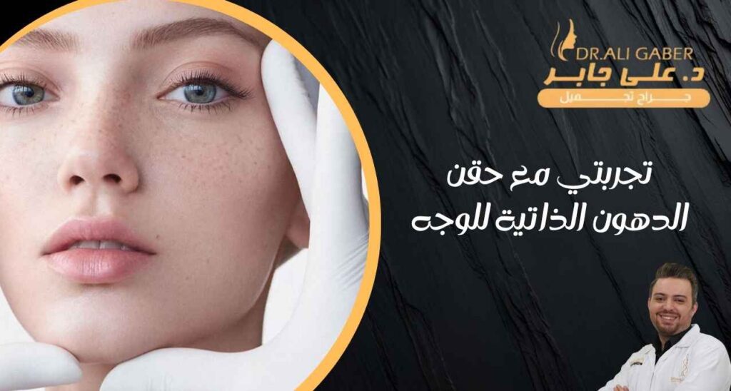 تجربتي مع حقن الدهون الذاتية للوجه