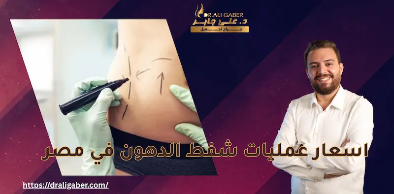 عمليات شفط الدهون في مصر