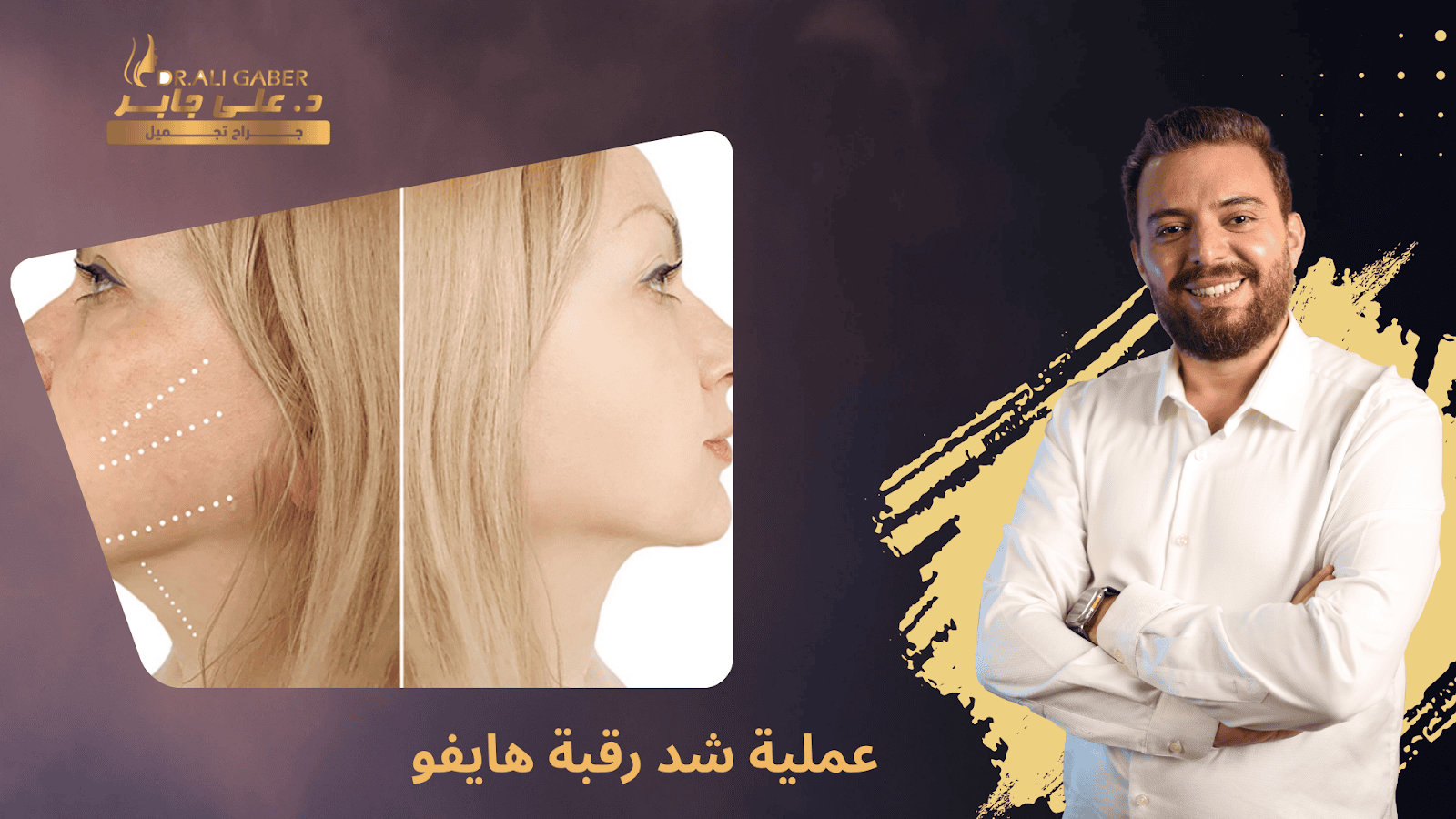 شد رقبة هايفو