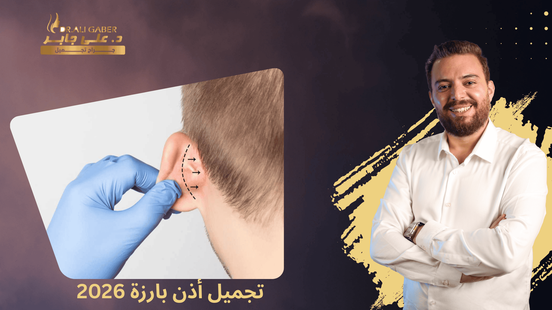تجميل أذن بارزة