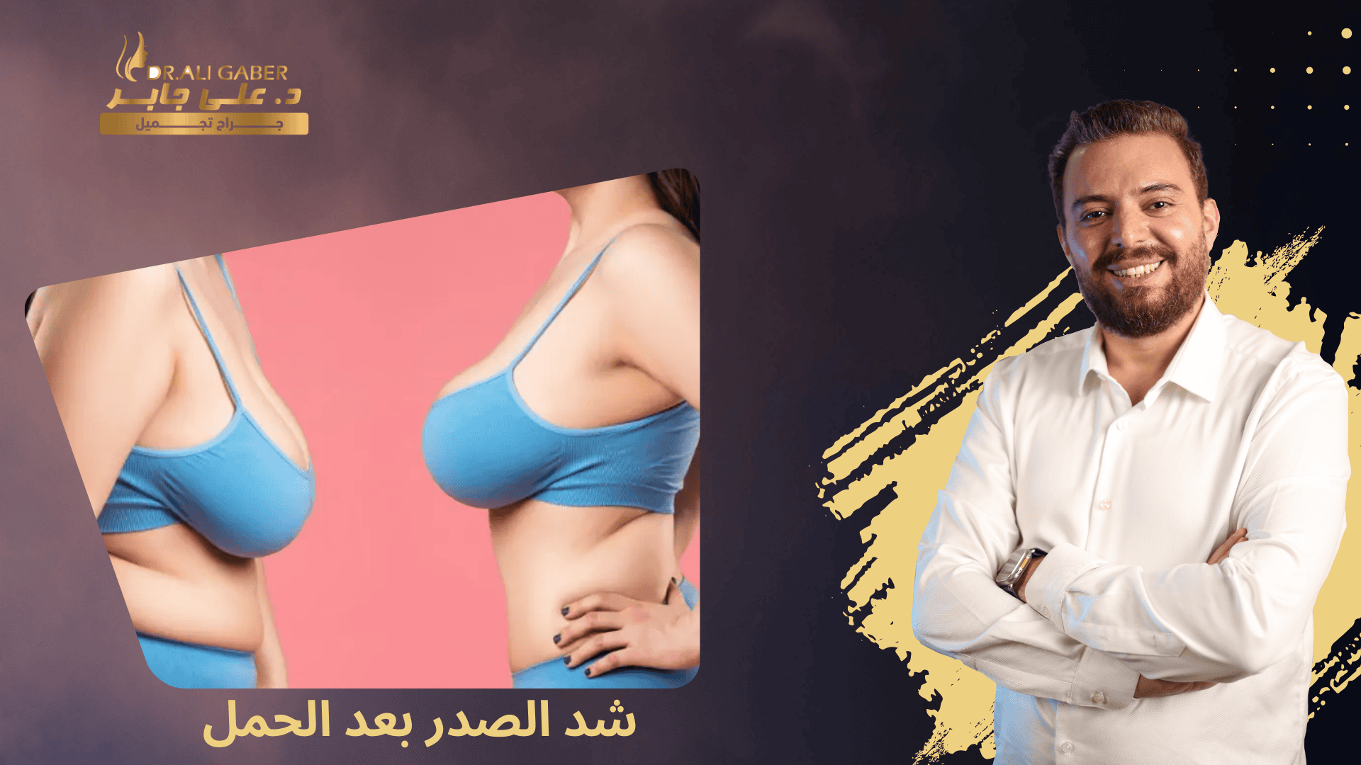 شد الصدر بعد الحمل