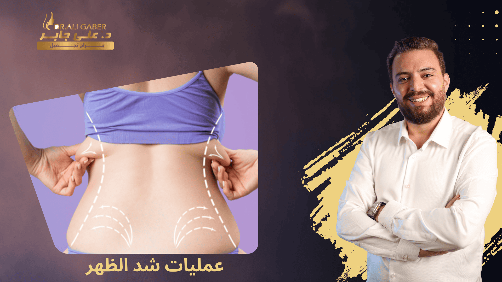 عمليات شد الظهر
