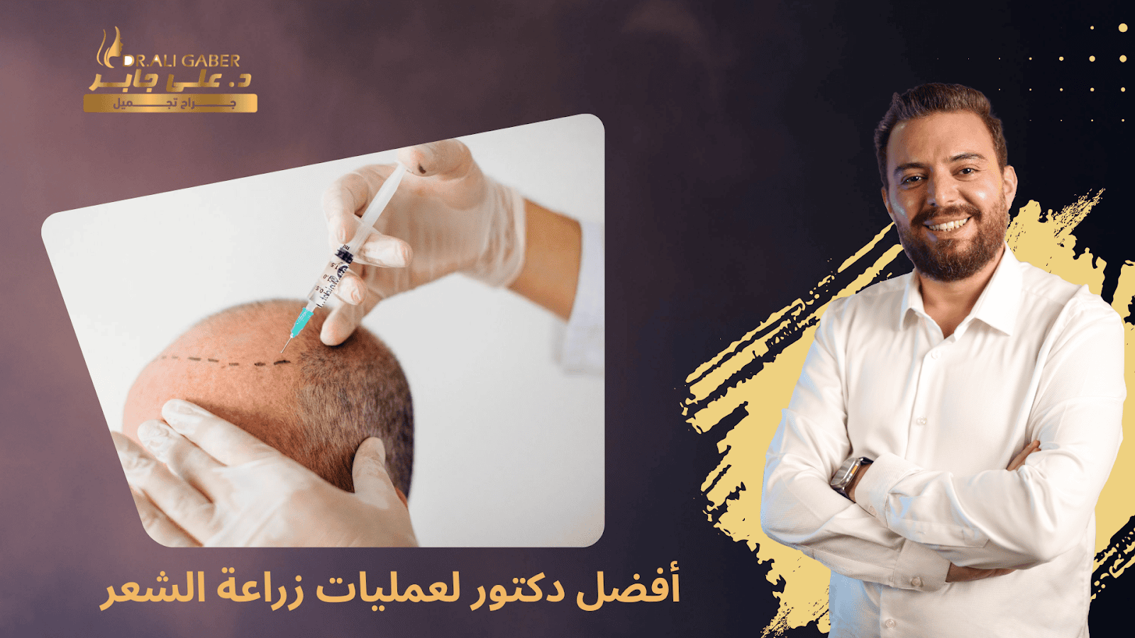 أفضل دكتور لعمليات زراعة الشعر