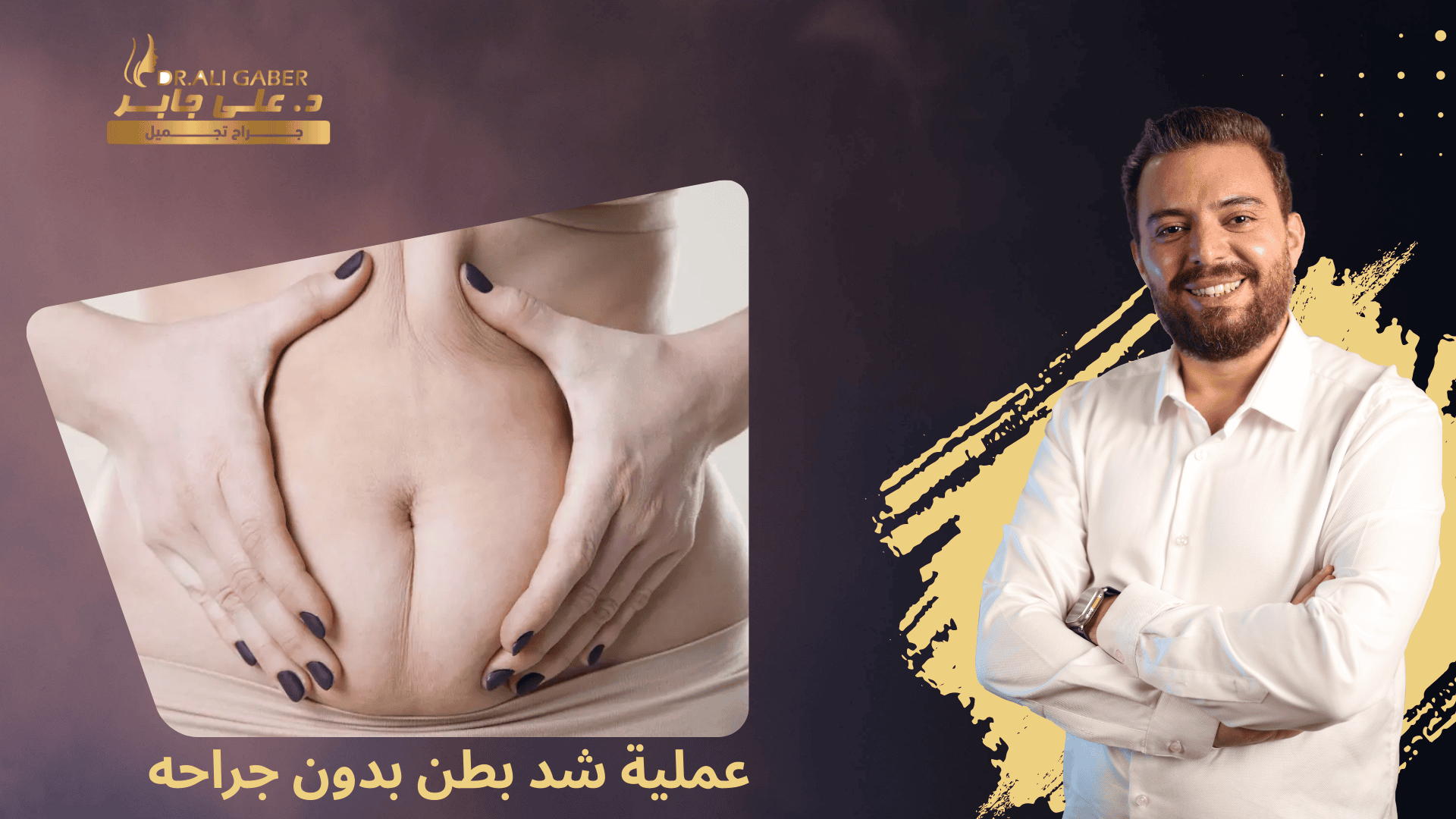 شد بطن بدون جراحه
