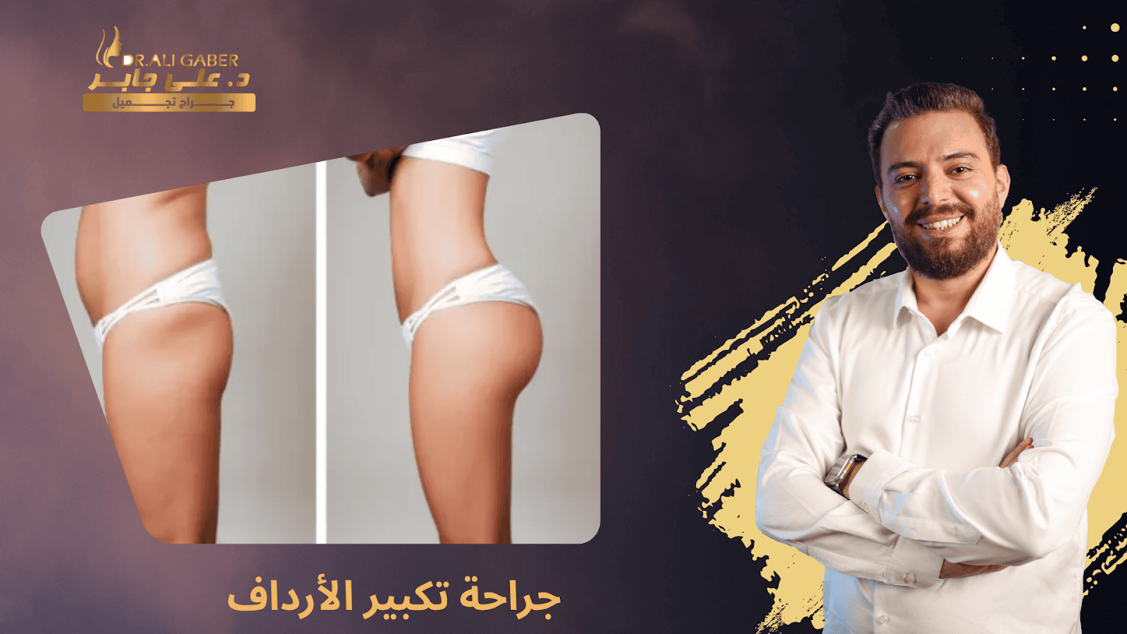 جراحة تكبير الأرداف