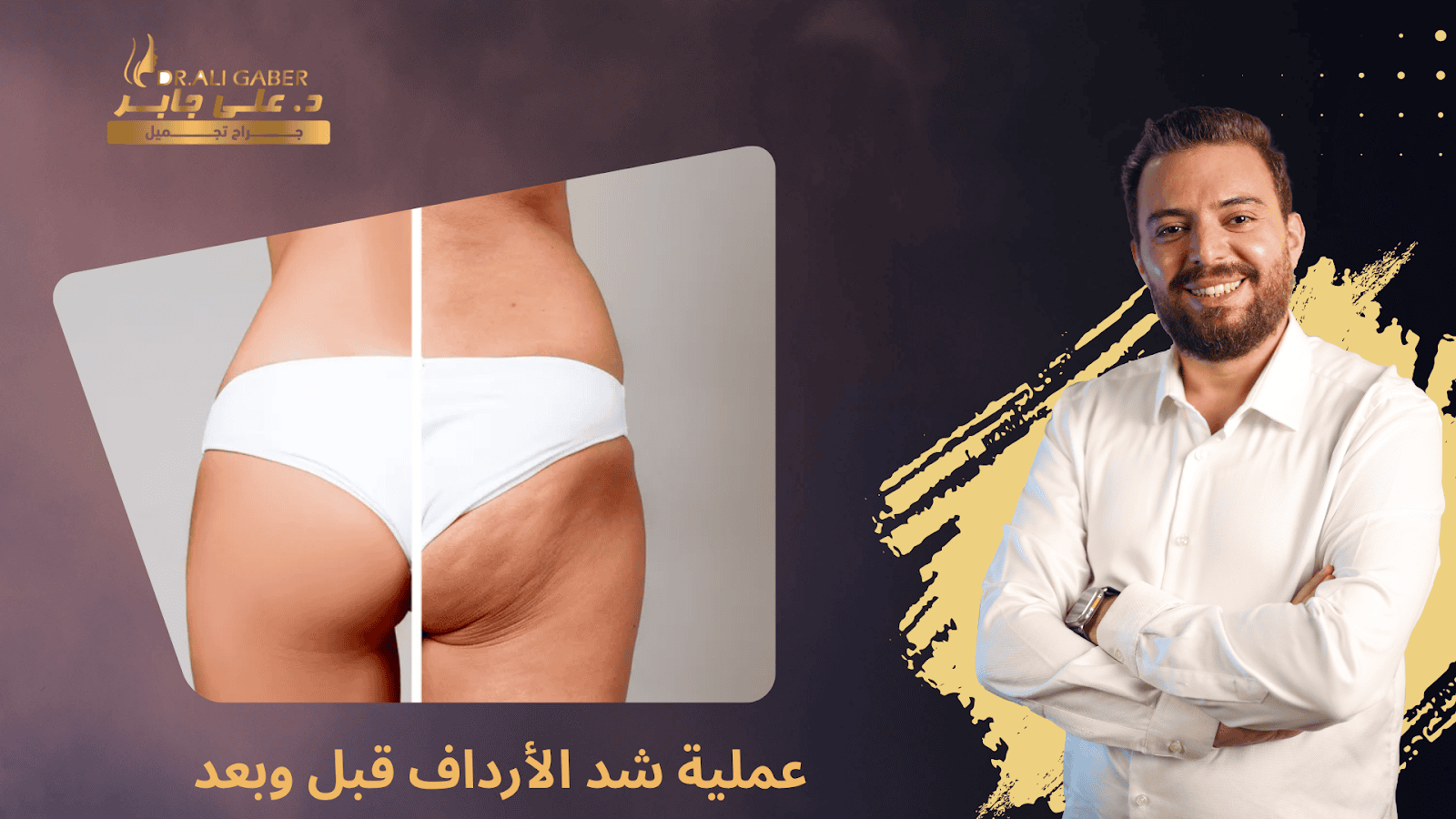 شد الأرداف قبل وبعد