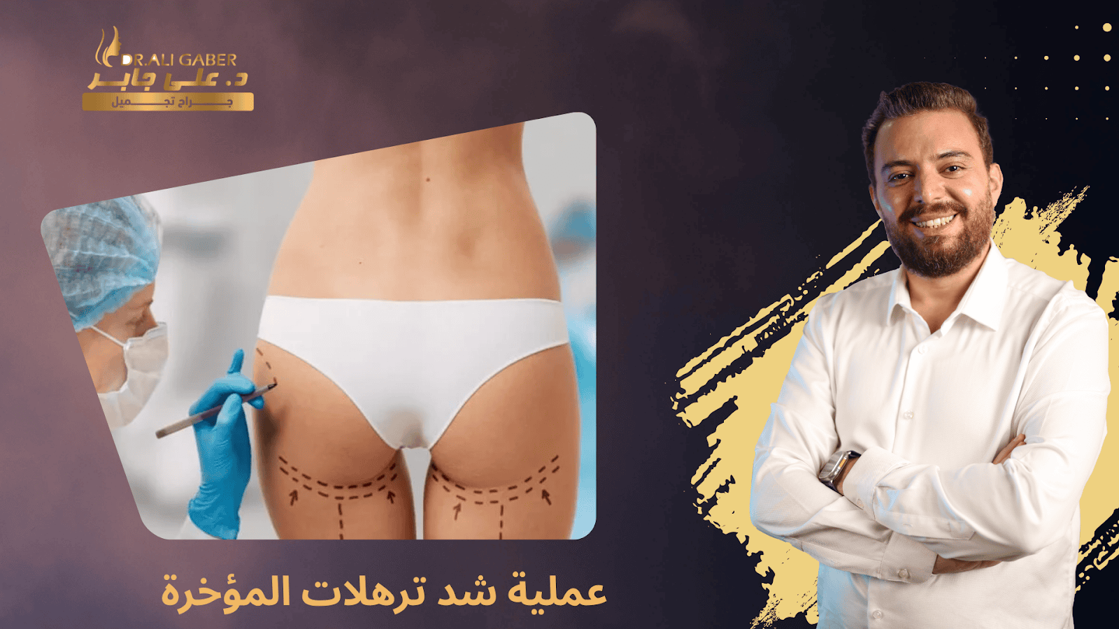 شد ترهلات المؤخرة