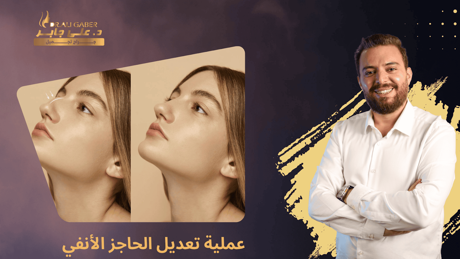 تعديل الحاجز الأنفي