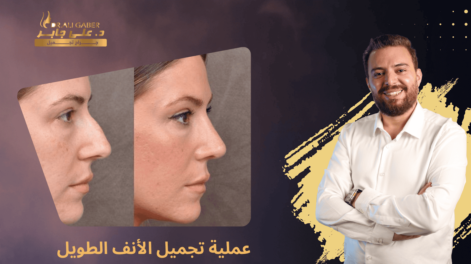 أفضل دكتور تجميل في الإسكندرية