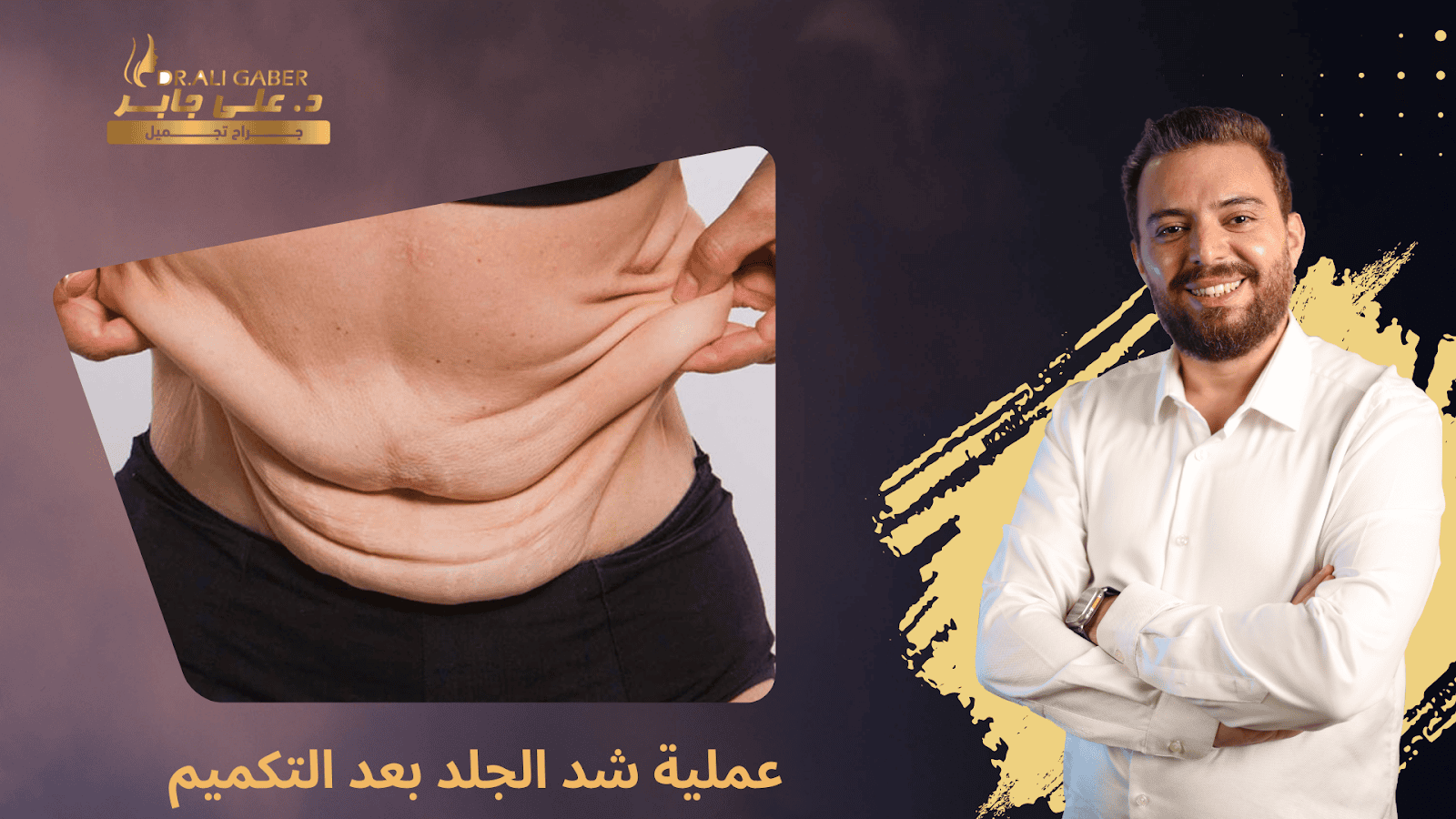 شد الجلد بعد التكميم