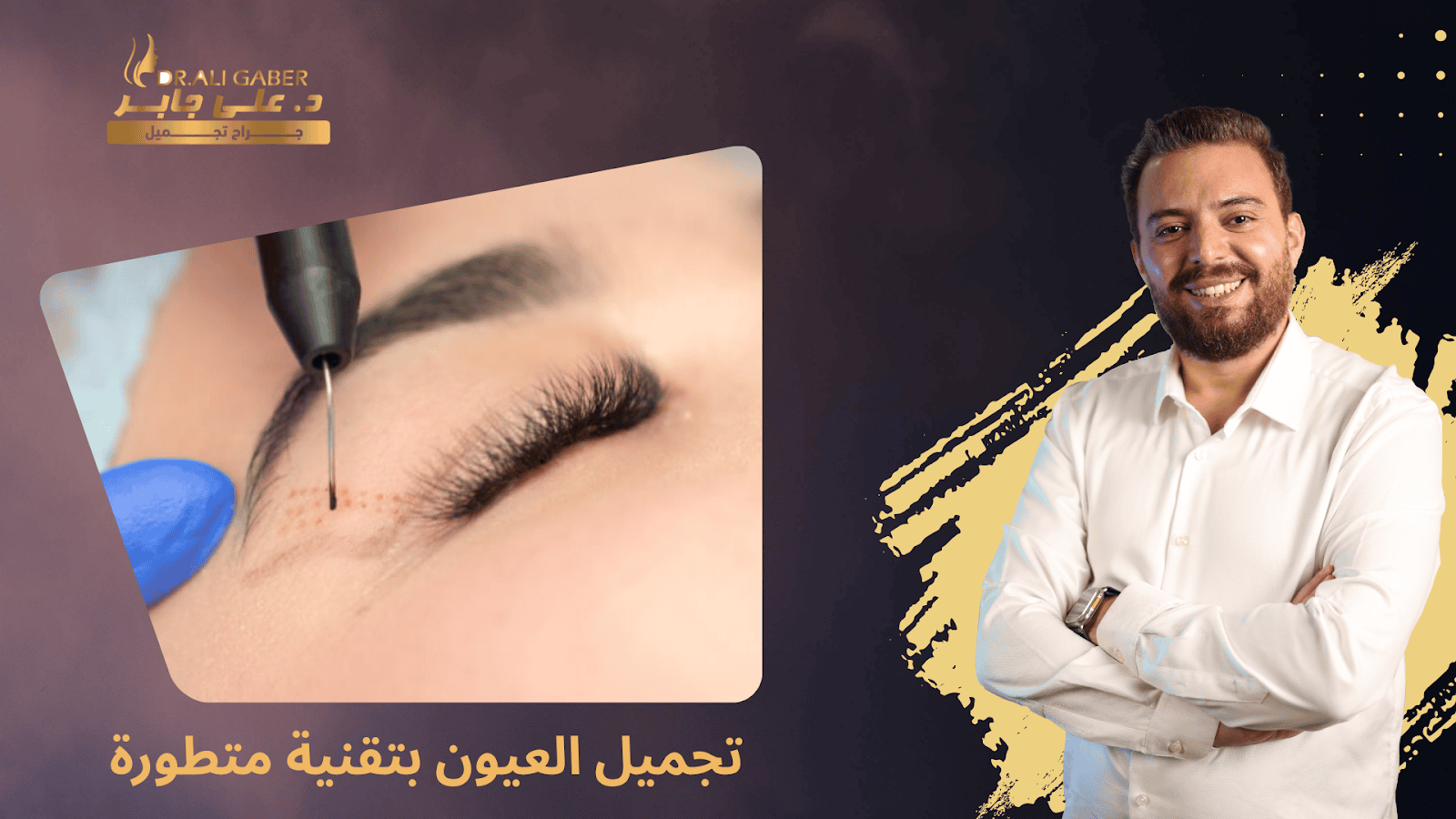 تجميل العيون