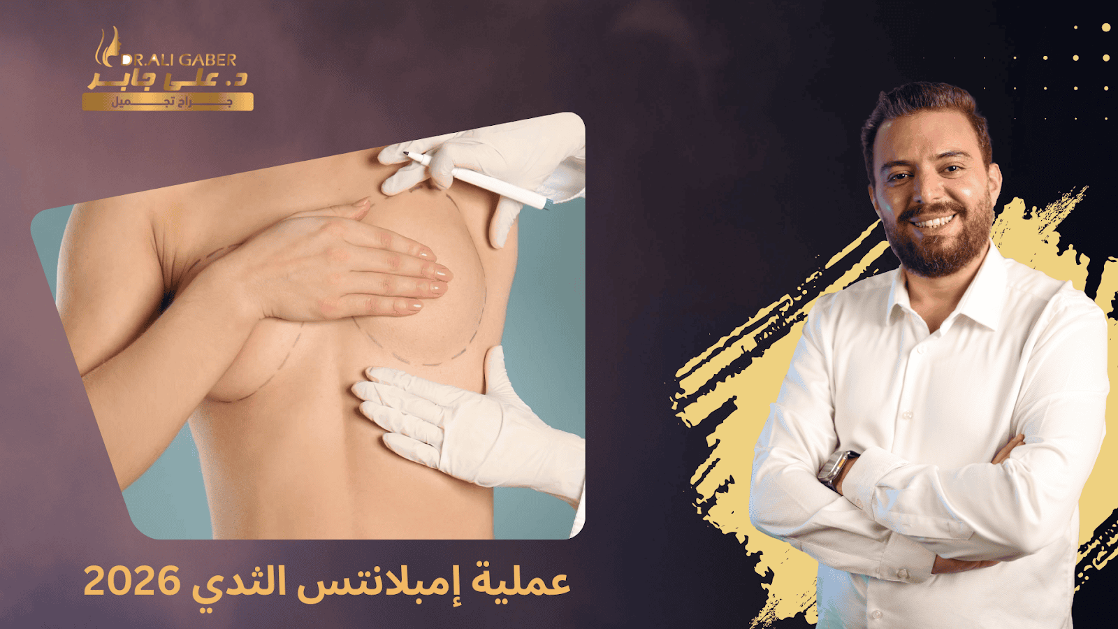 إمبلانتس الثدي