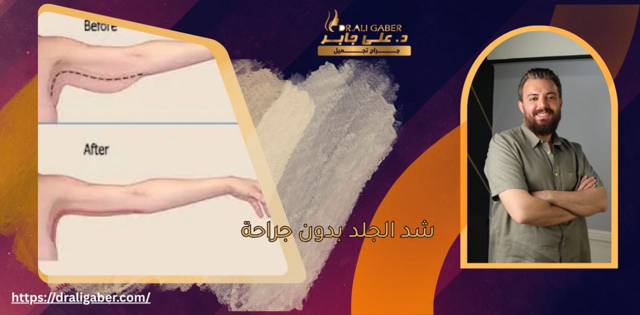 شد الجلد بدون جراحة