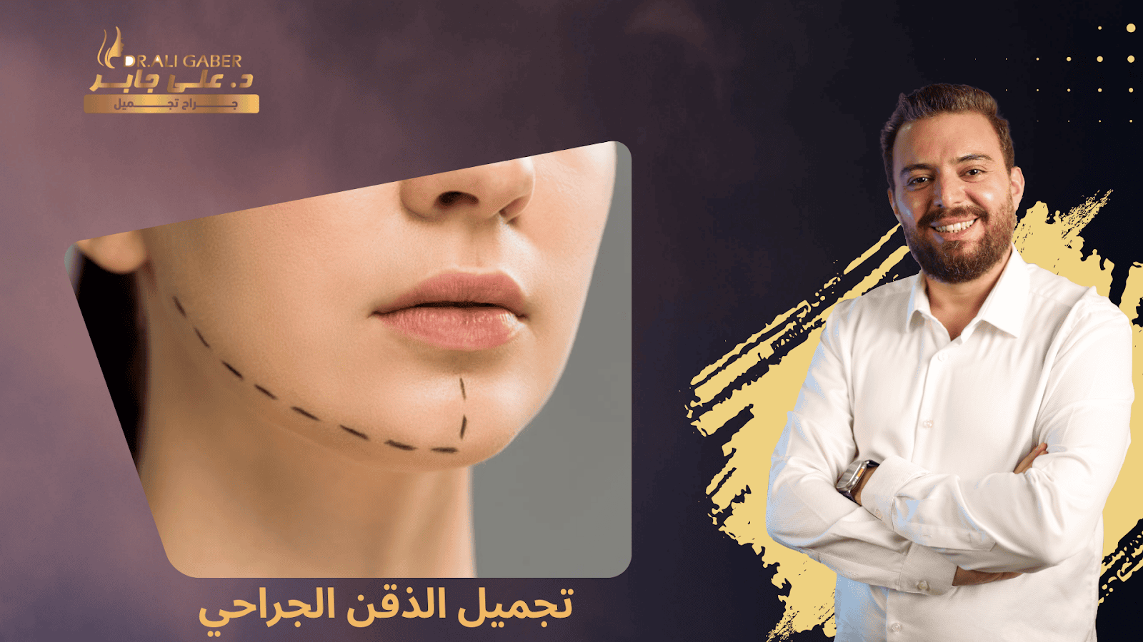 تجميل الذقن الجراحي