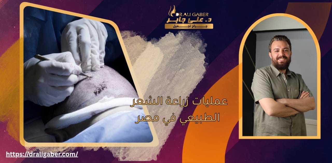 زراعة الشعر الطبيعي
