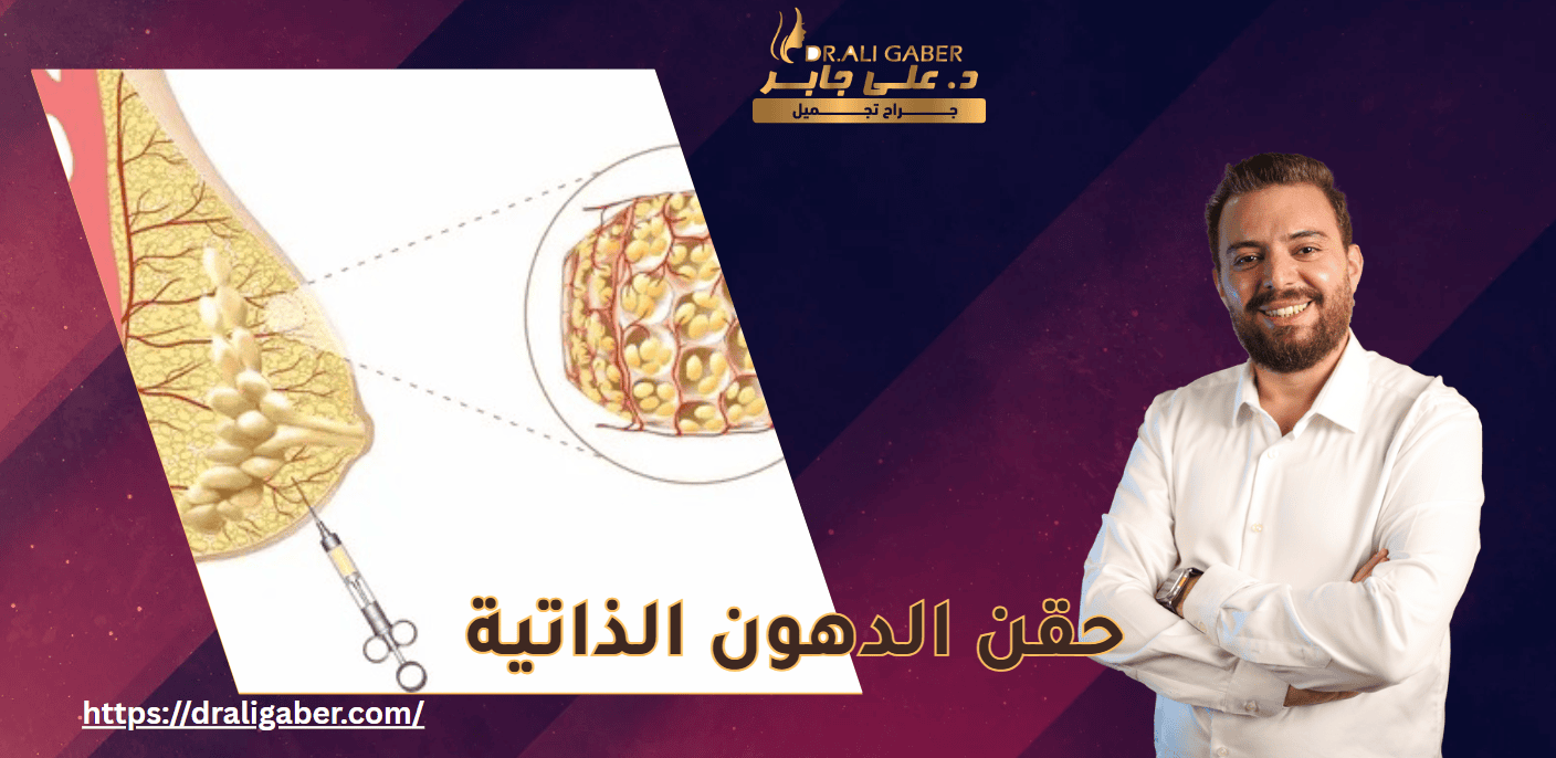  حقن الدهون الذاتية