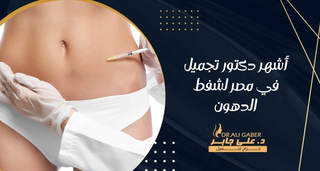 أشهر دكتور تجميل في مصر لشفط الدهون