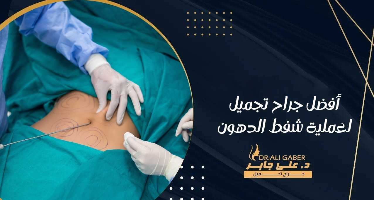أفضل جراح تجميل لعملية شفط الدهون