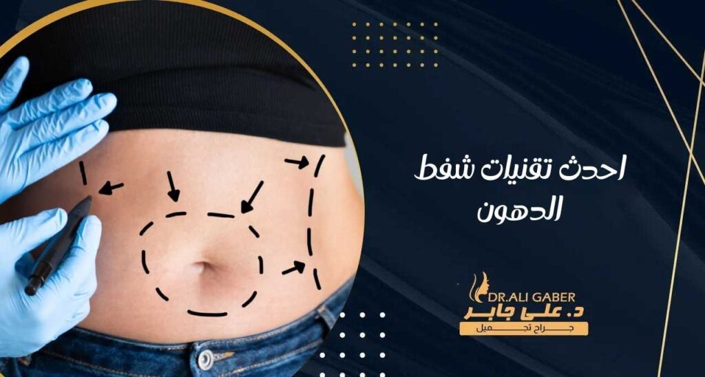 احدث تقنيات شفط الدهون