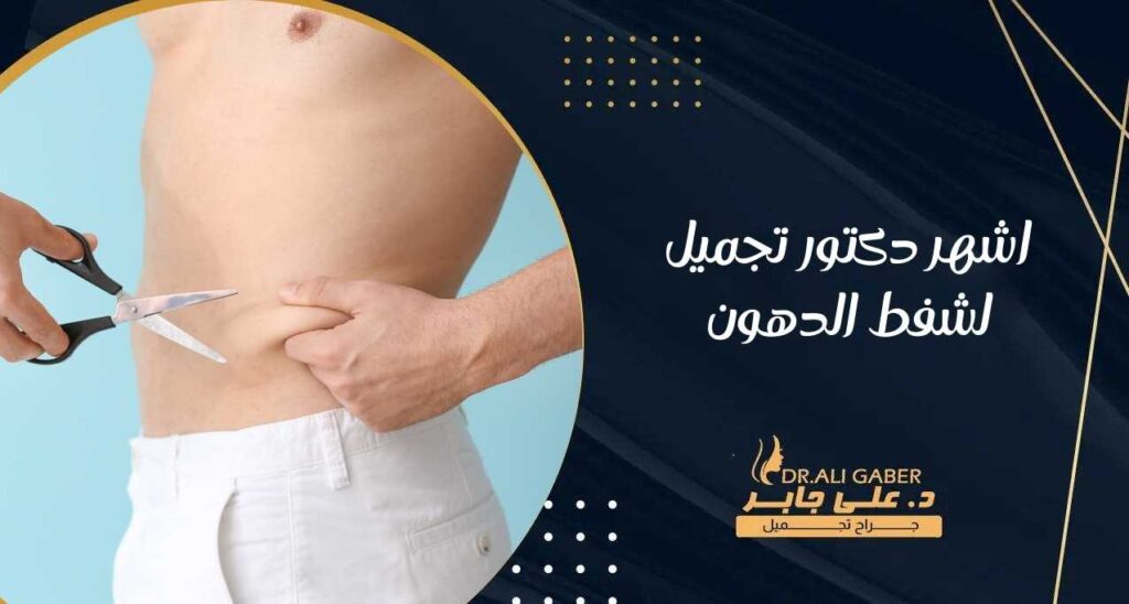 اشهر دكتور تجميل لشفط الدهون
