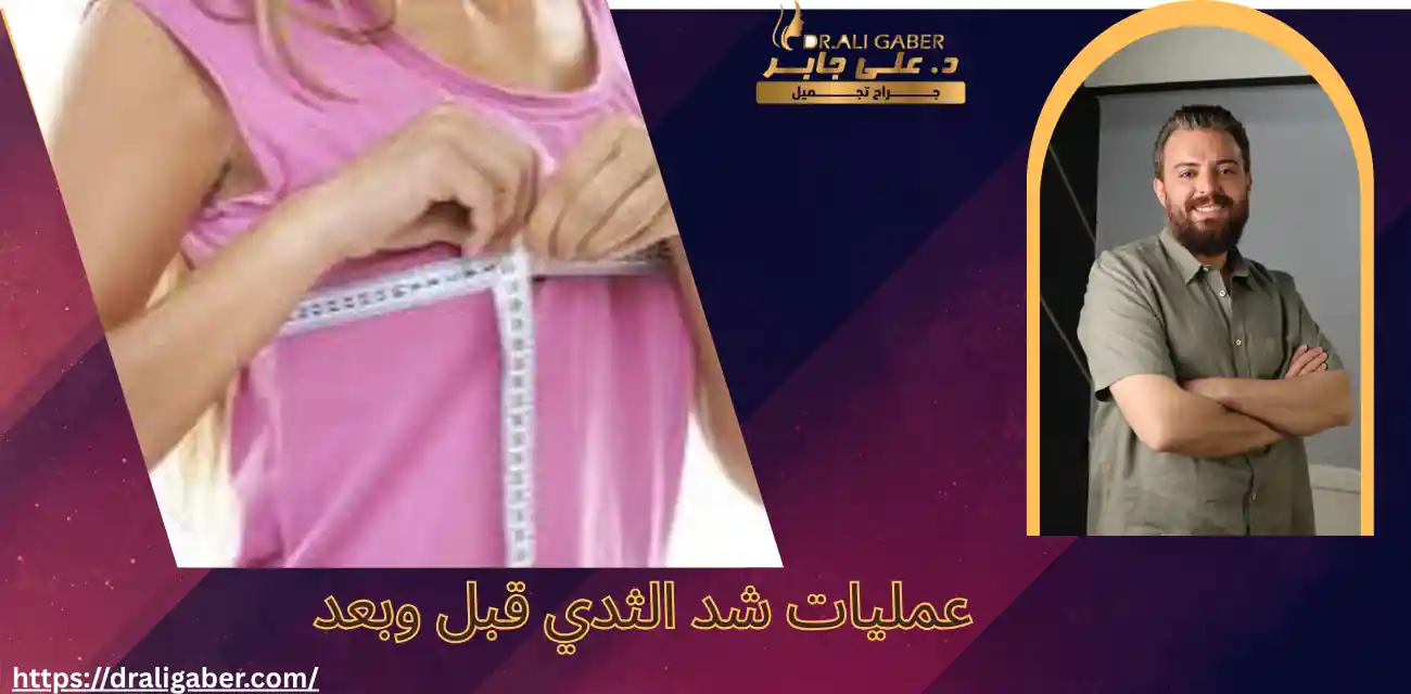 عمليات شد الثدي قبل وبعد