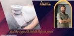 سعر عملية شفط الدهون بالفيزر