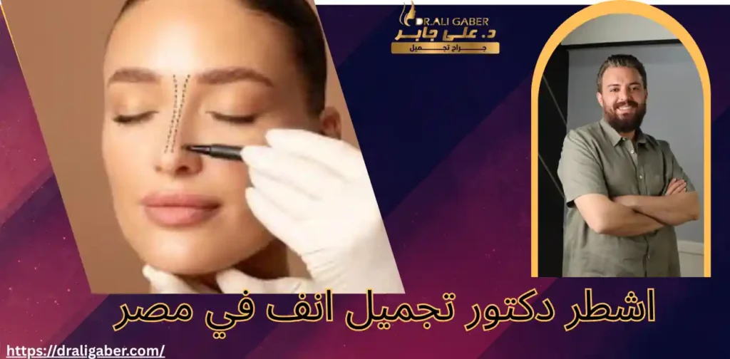 اشطر دكتور تجميل انف في مصر