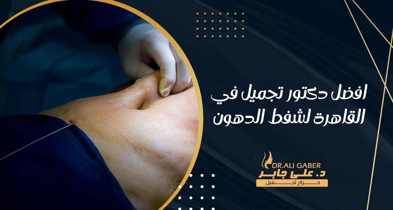 افضل دكتور تجميل في القاهرة لشفط الدهون