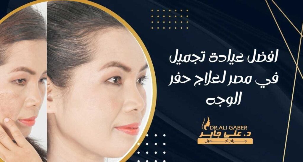 افضل عيادة تجميل في مصر لعلاج حفر الوجه
