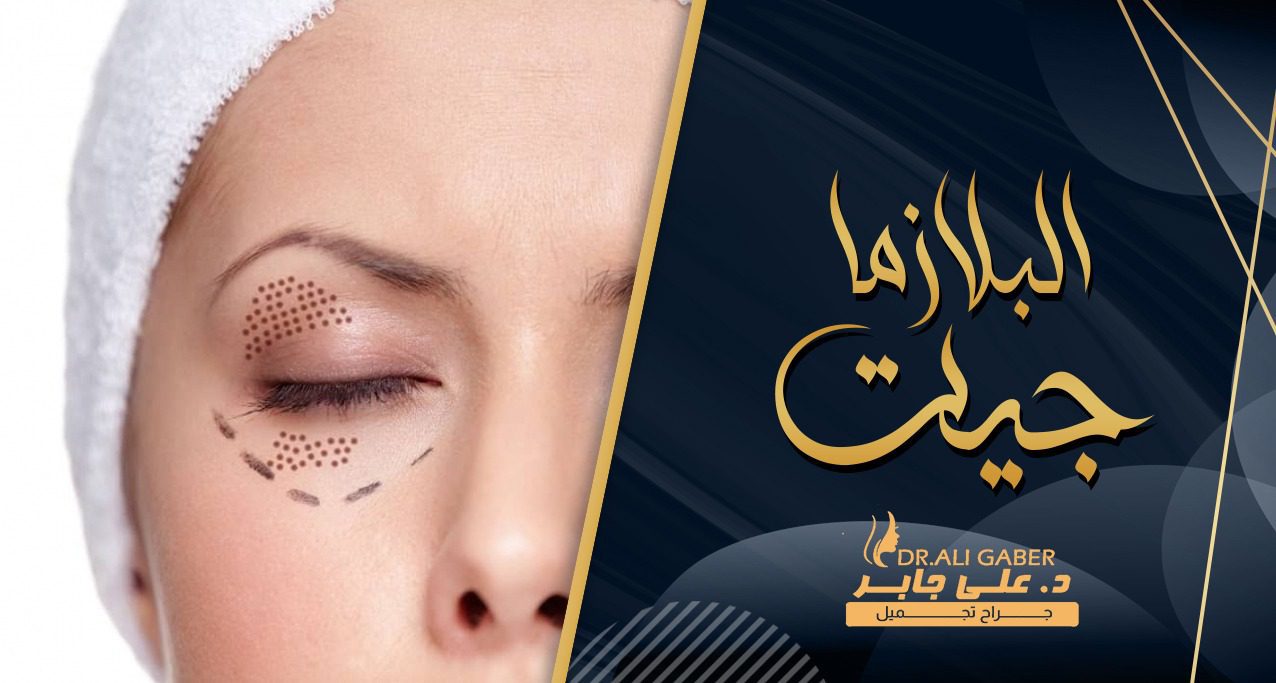 البلازما جيت لشد الجفون العلوية والسفلية
