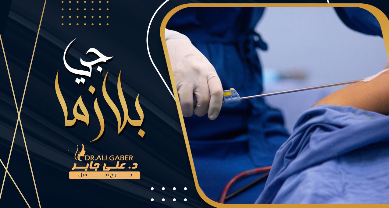 الجت بلازما