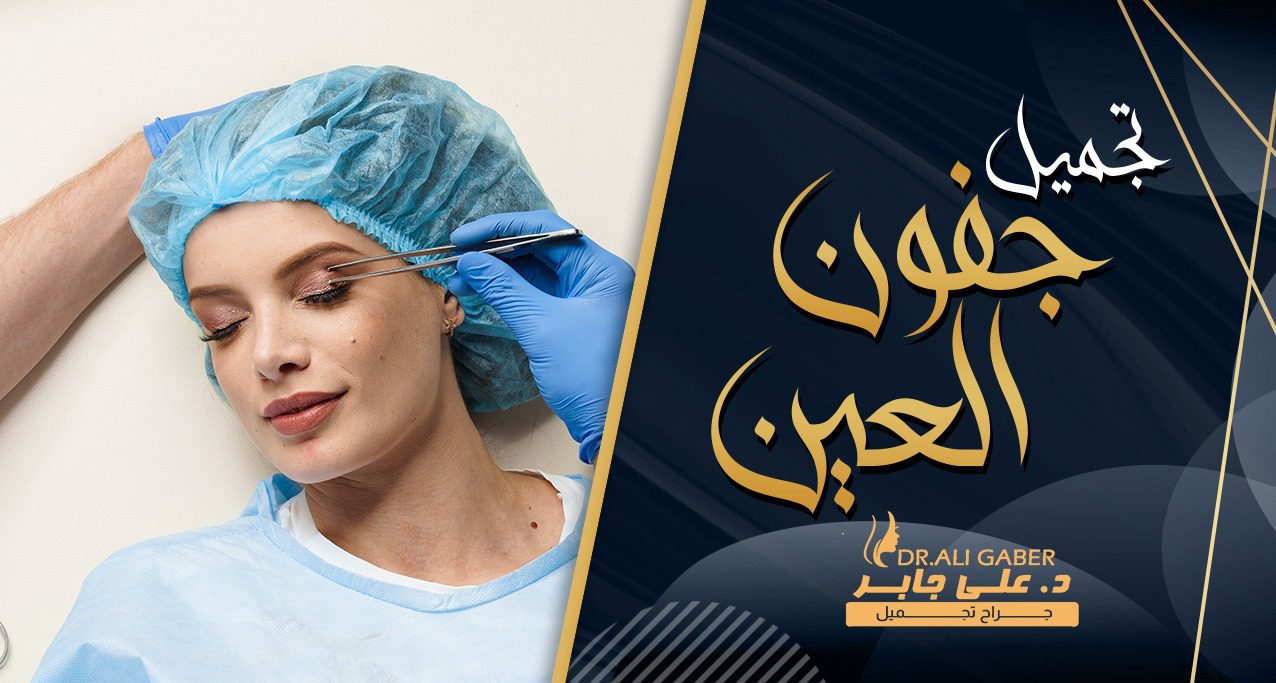 عملية شد الجفون