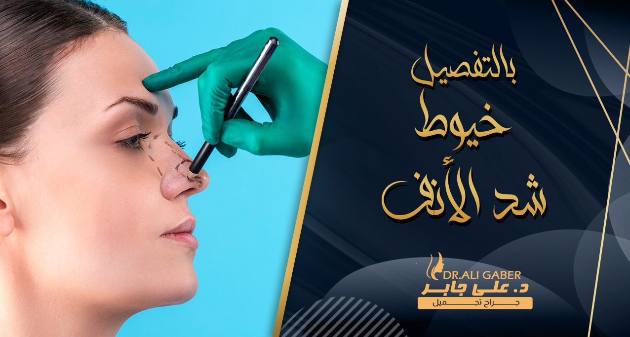 معلومات عن خيوط الأنف