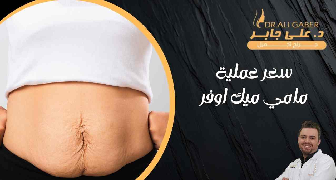 سعر-عملية-مامي-ميك-اوفر