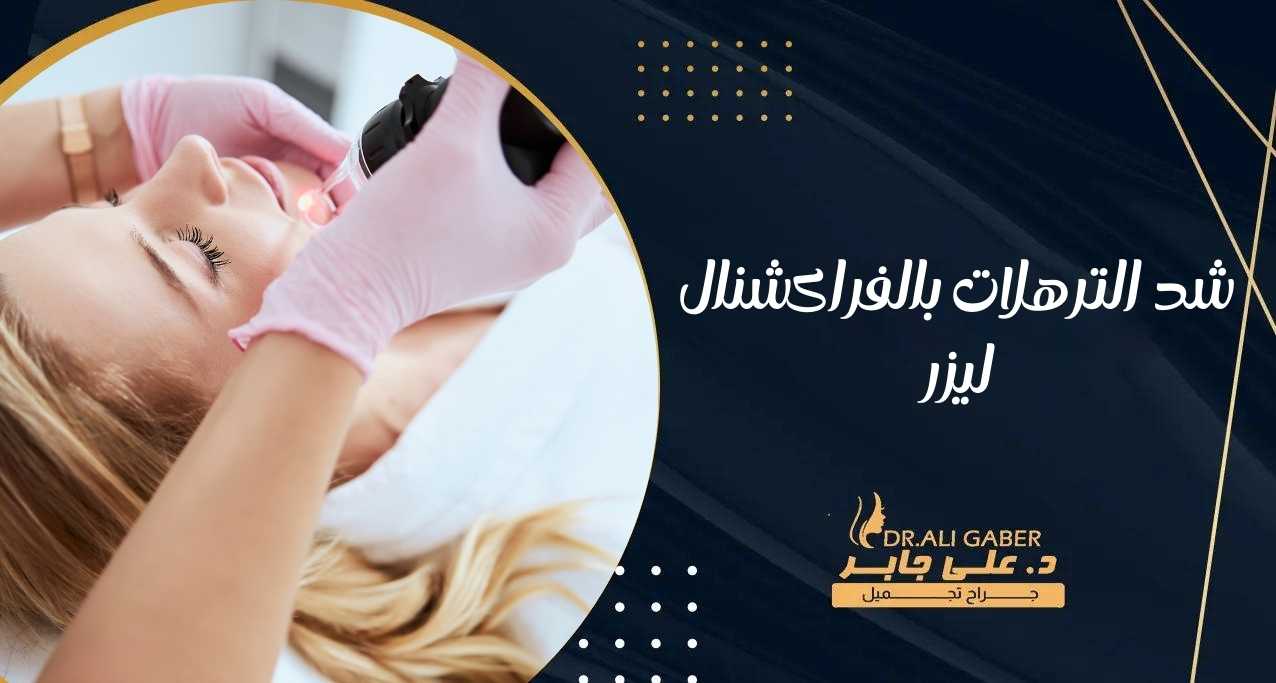 شد الترهلات بالفراكشنال ليزر