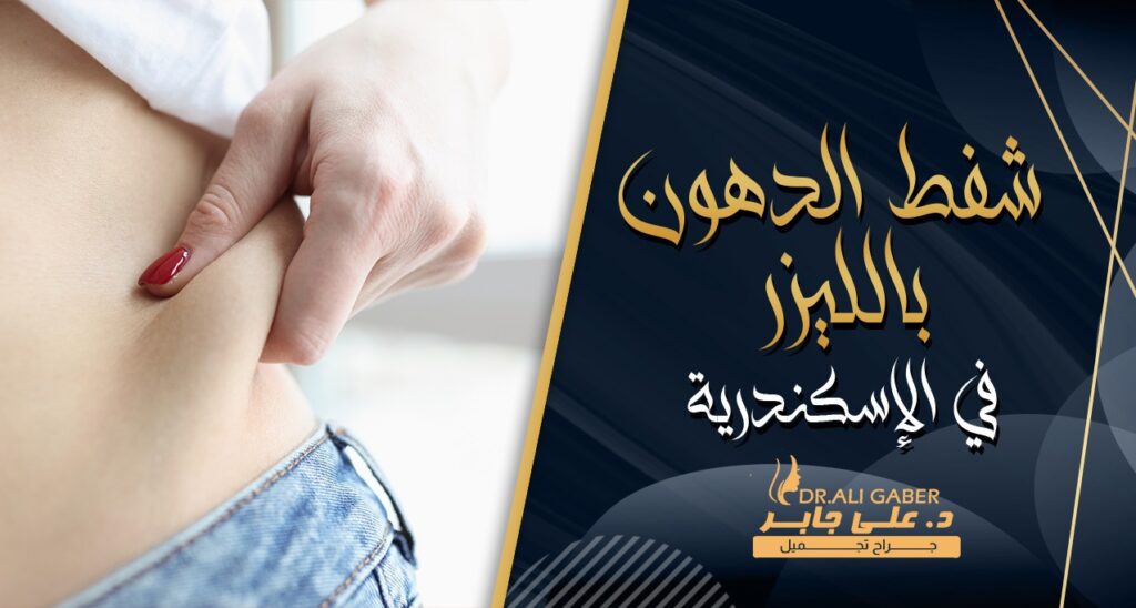 شفط الدهون بالليزر فى الاسكندرية