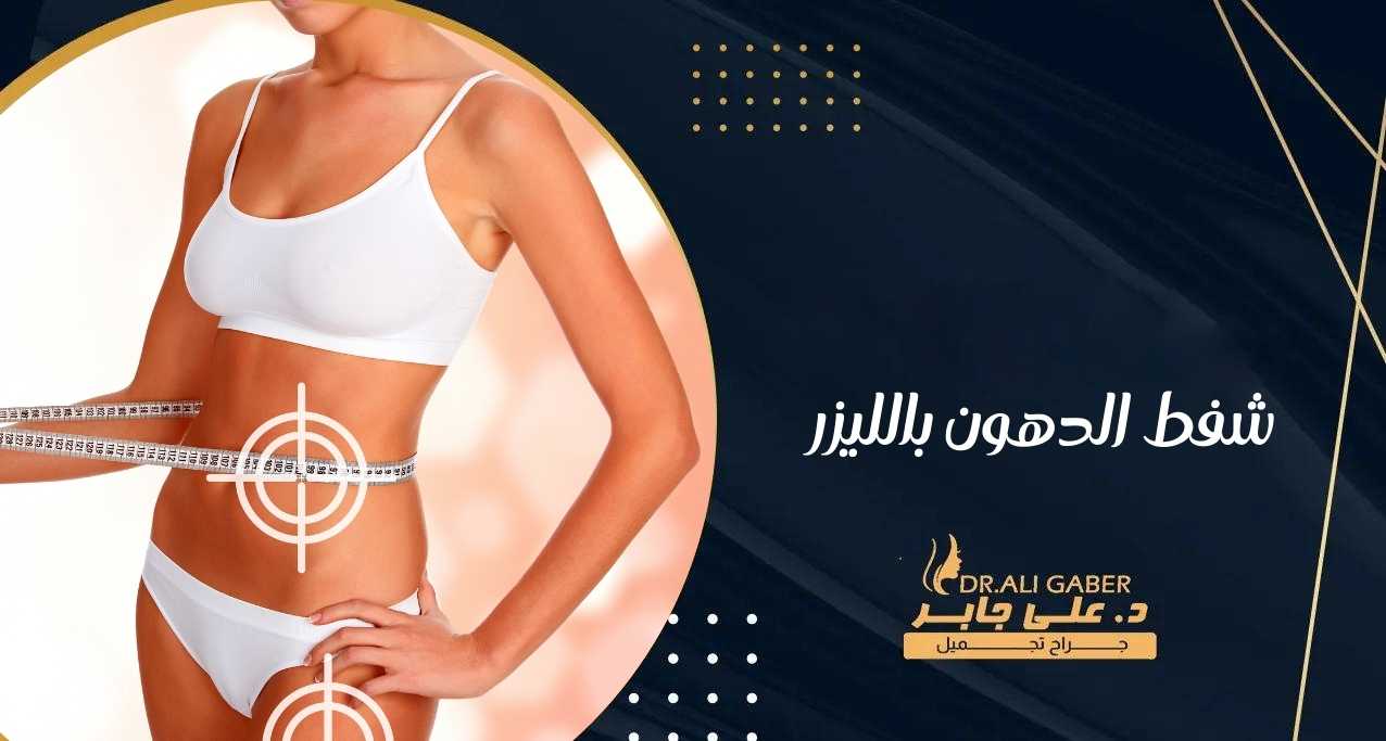 شفط الدهون بالليزر