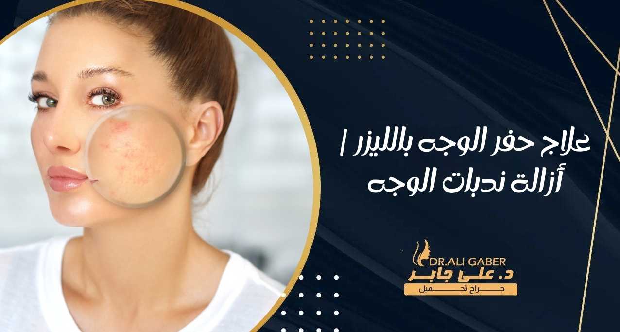 علاج حفر الوجه بالليزر أزالة ندبات الوجه
