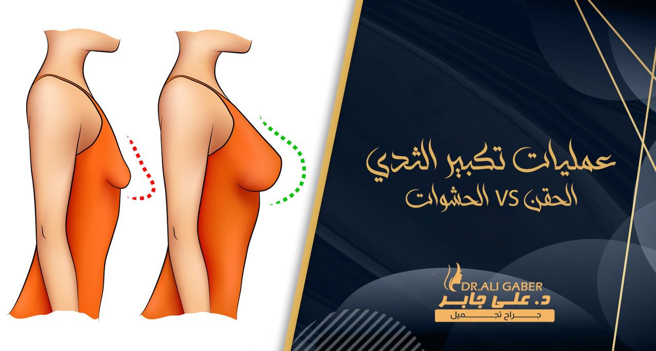 عمليات تكبير الثدي بالحشوات والحقن