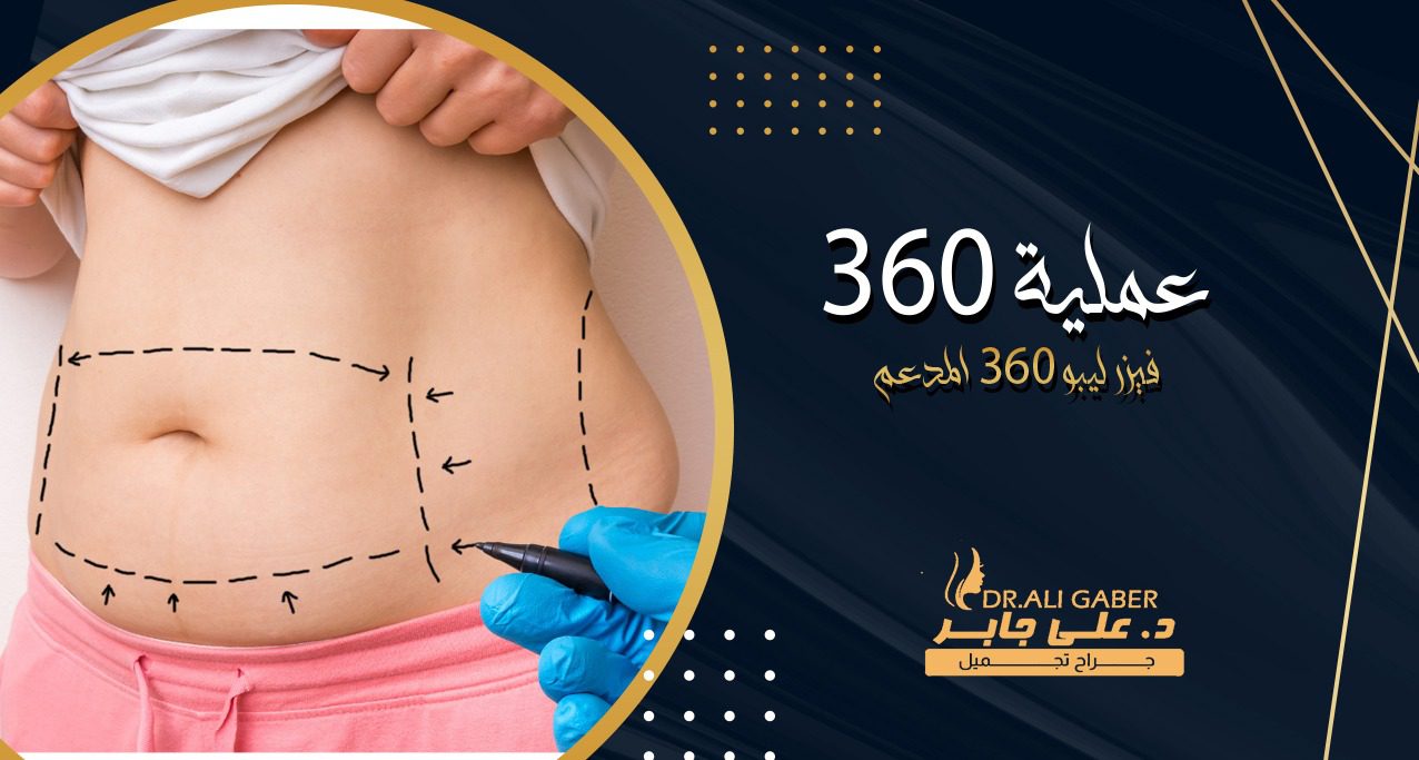 عملية 360 لنحت الجسم بالكامل