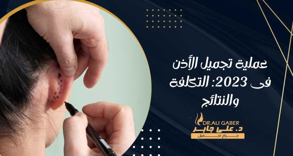 عملية تجميل الأذن فى 2023