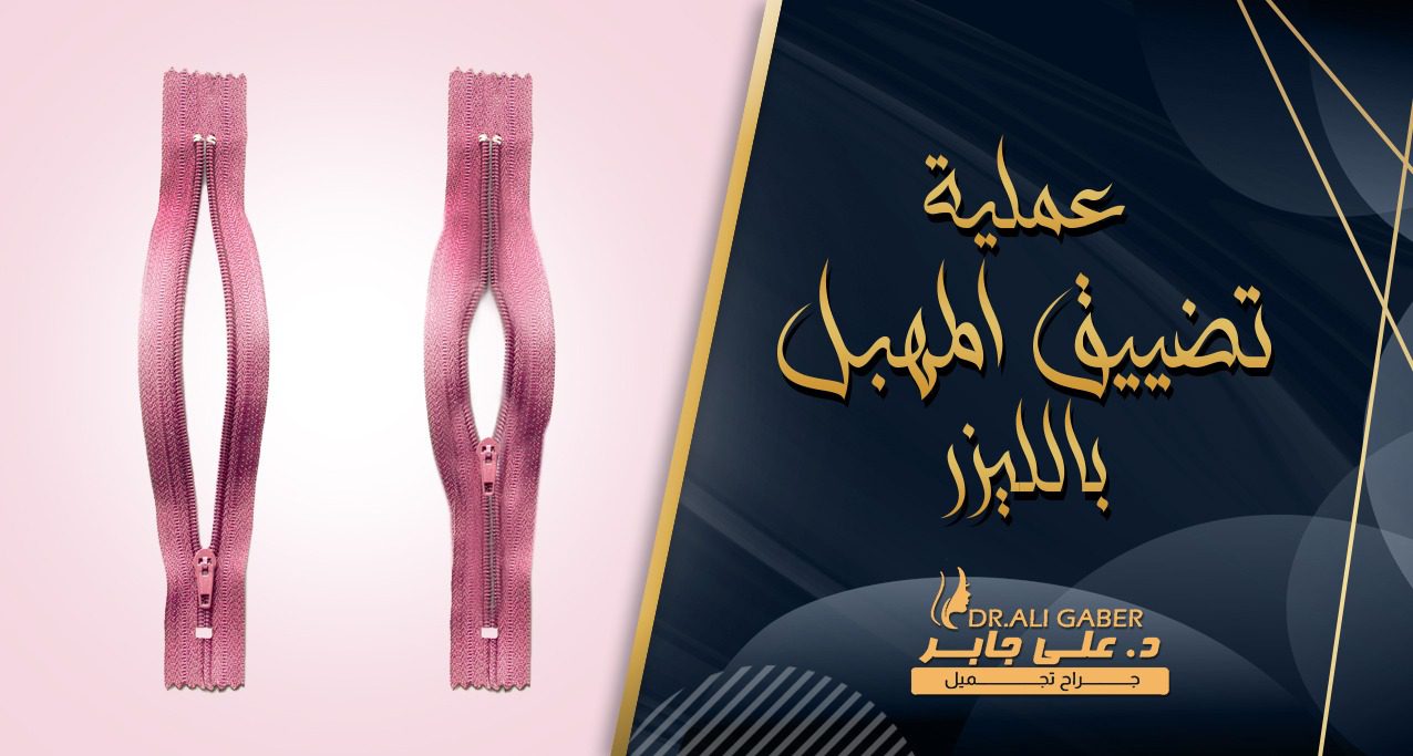 عملية تضييق المهبل