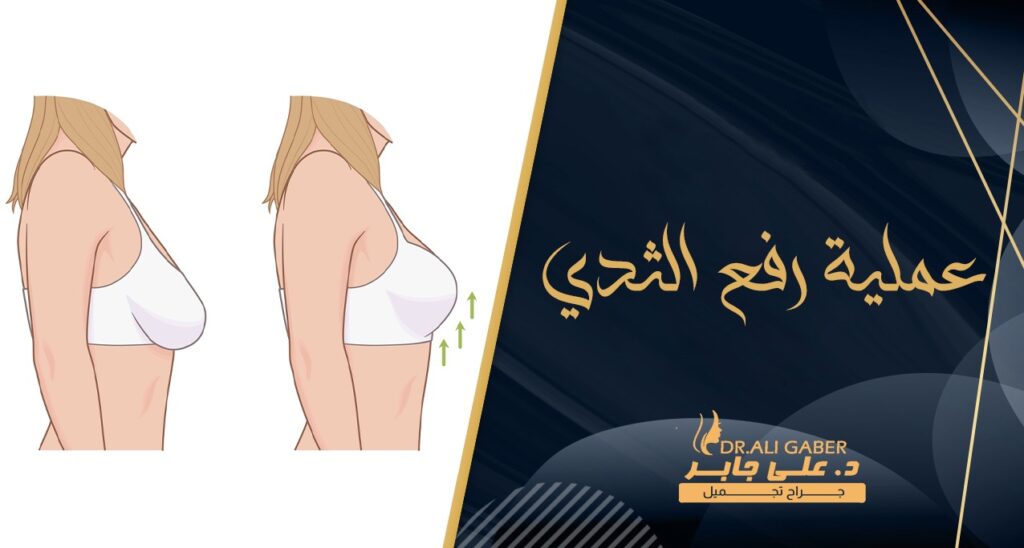 عملية رفع الثدي وشده