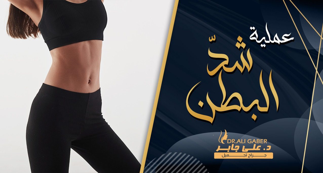 عملية شد البطن