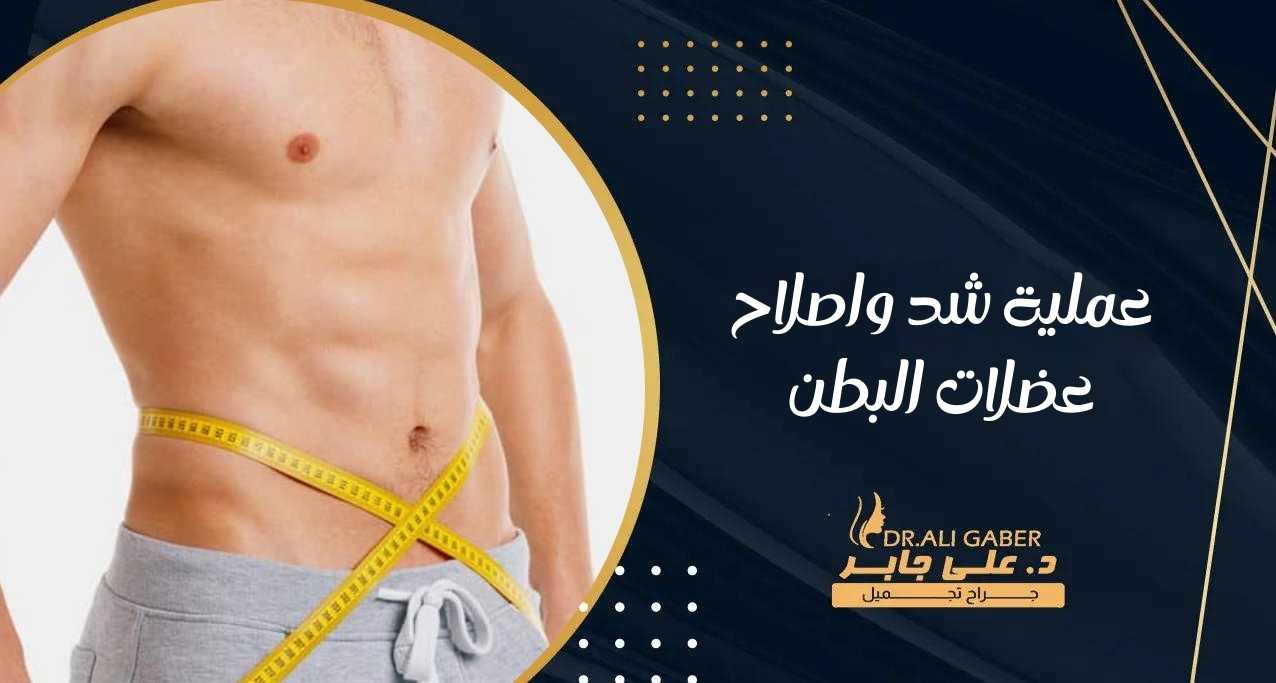 عملية شد واصلاح عضلات البطن