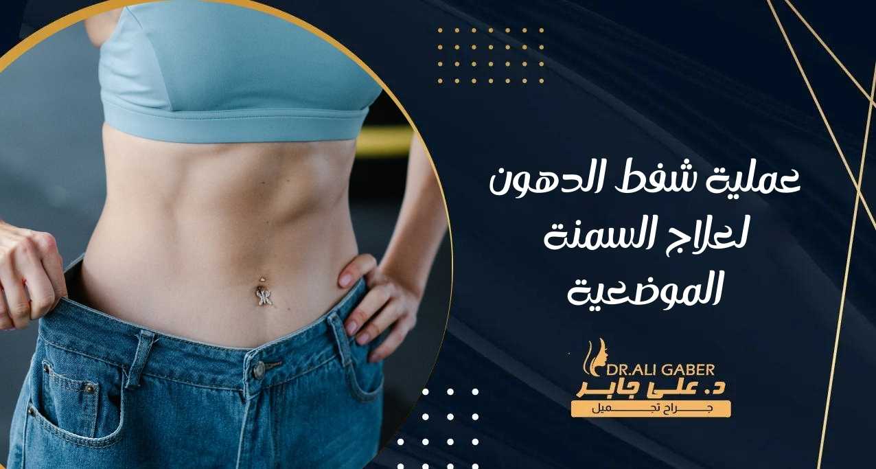 عملية شفط الدهون لعلاج السمنة الموضعية