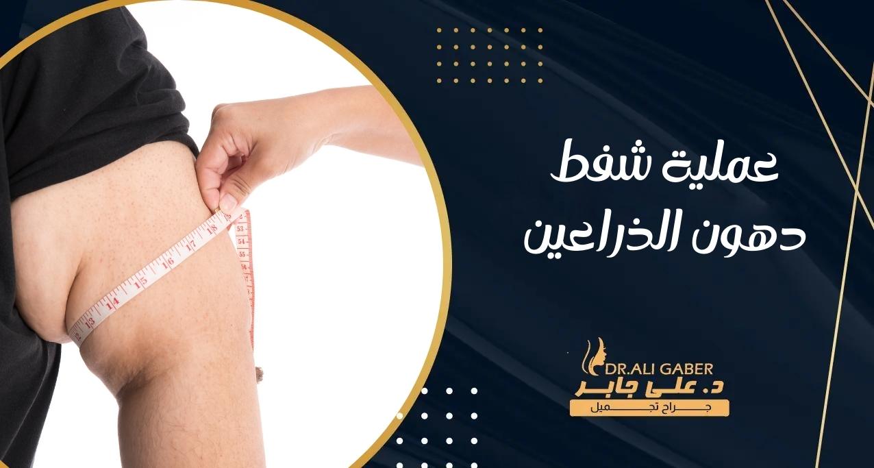 عملية شفط دهون الذراعين