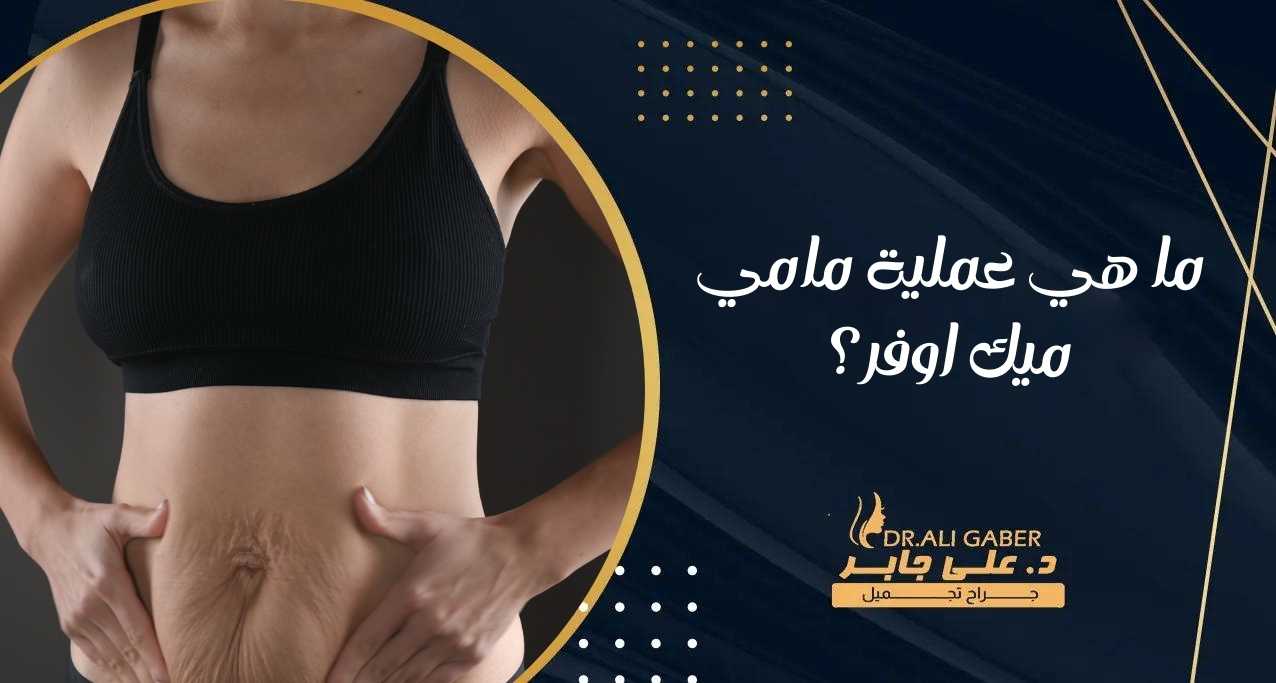 ما هي عملية مامي ميك اوفر؟
